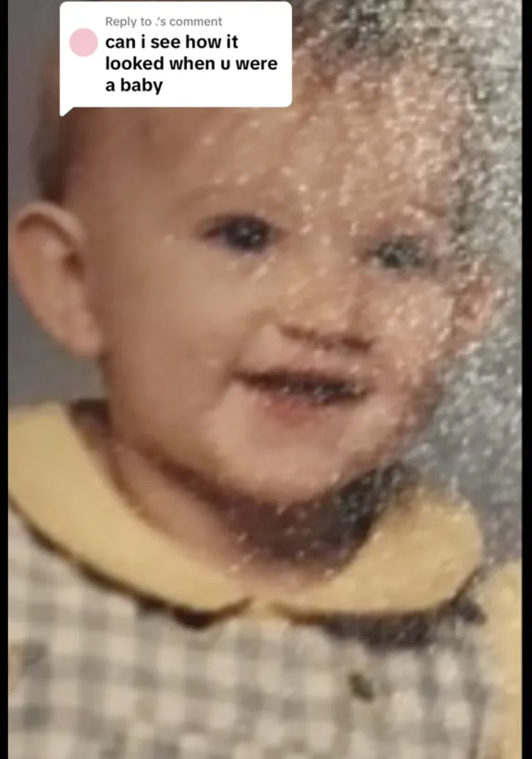 Devyn Aiken as a baby, dressed in a checkered outfit — years before rhinoplasty would become part of her story. | Source: Tiktok/doseofdevy